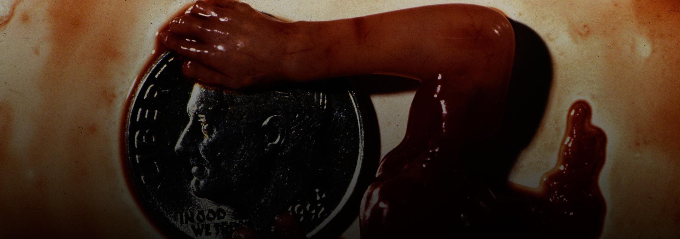 Com coração ainda batendo, criança abortada tem cérebro arrancado para ser vendido nos EUA