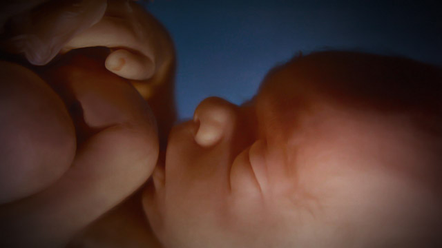 Legalização do aborto no Brasil