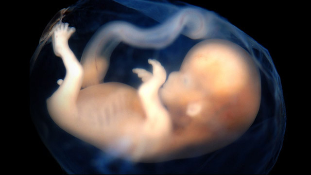 A Nova Estratégia Mundial do Aborto (I)