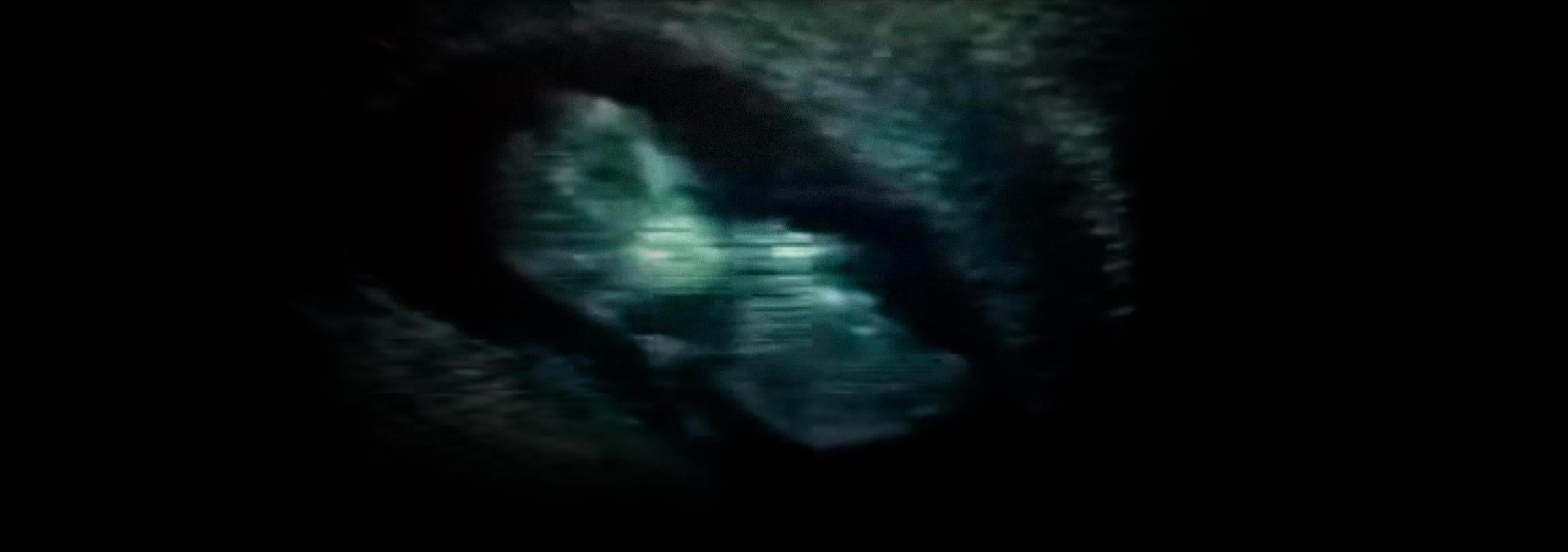 Vídeo de ultrassom mostra bebê de 11 semanas pulando no ventre materno