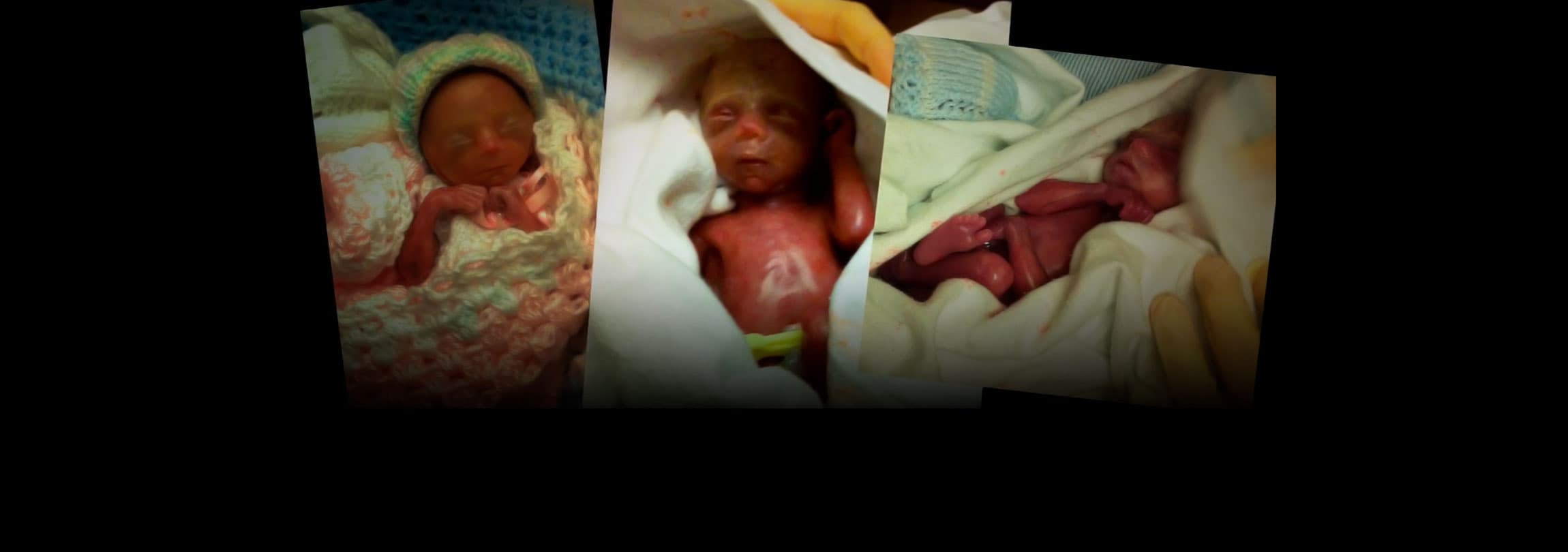 Pais de trigêmeos prematuros encontram sentido no impensável